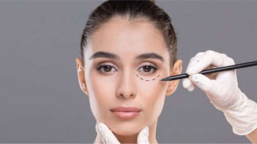 Blepharoplasty