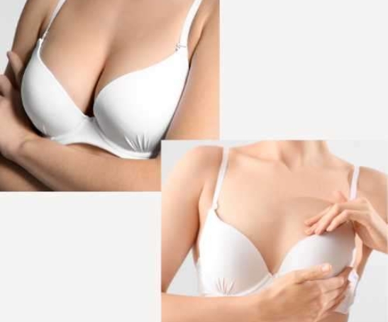 Breast reduction