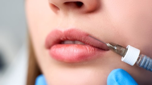 Lip reduction